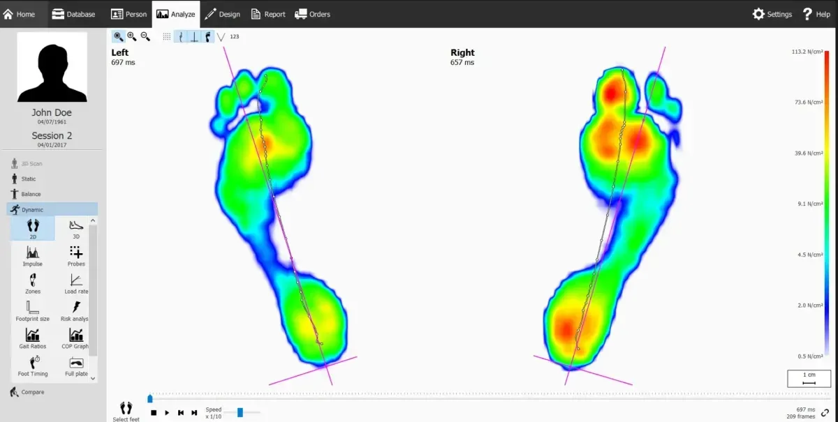 Gaitscan software showing colour pressure maps of both feet