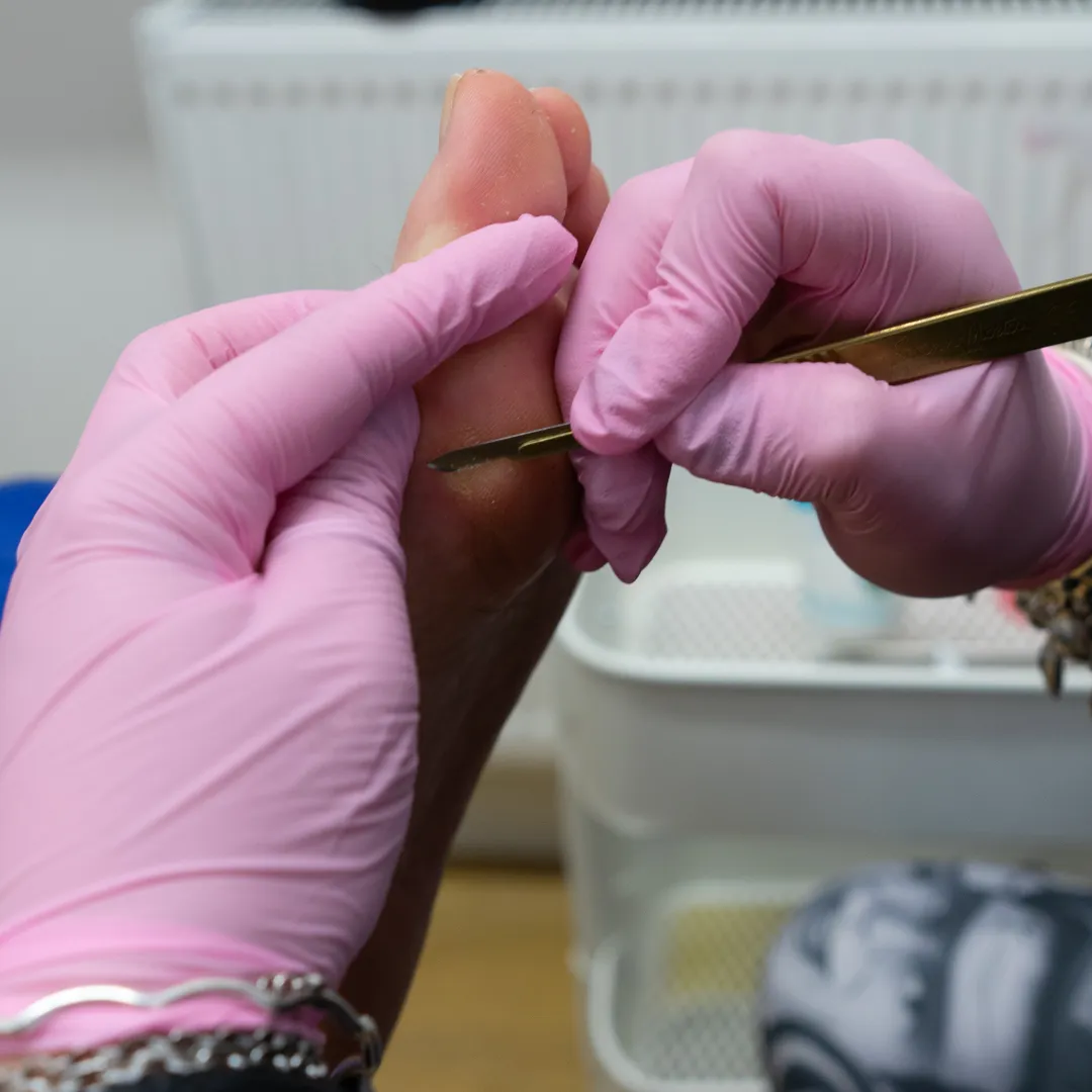 Gloved podiatrist trimming a patient's toenail